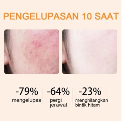 🔥 65% OFF for the Last 3 Hours! ⏰ Orange Enzyme Exfoliating Gel 🍊 — The Gentle Miracle Your Skin Has Been Crying Out For